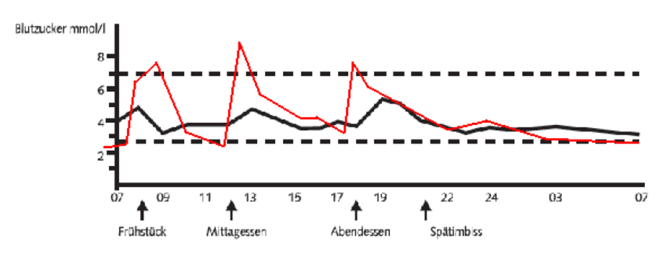 Diabetes Elterninformation Kispi Wiki