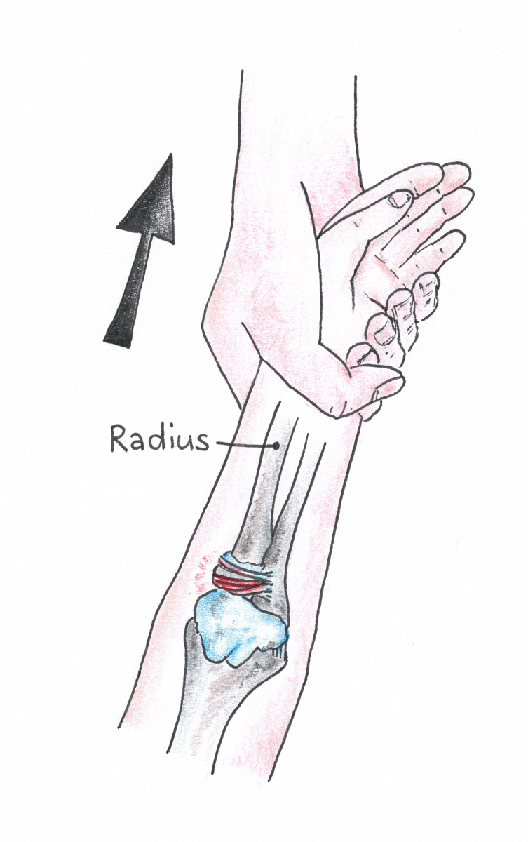 Kispi-Wiki | Pronation douloureuse